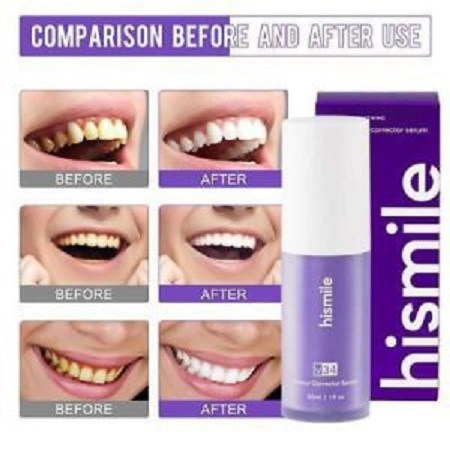 خمیر دندان سفید کننده و جرم گیر فوری های اسمایل مدل hismile v34 حجم 30 میلی لیتر